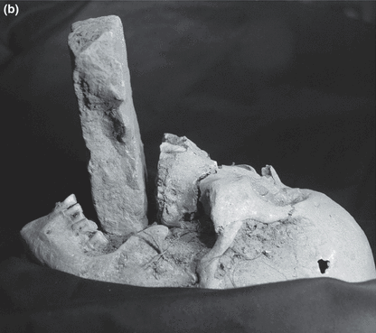 Venice Vampire Buried with Brick in Mouth | The Mary Sue