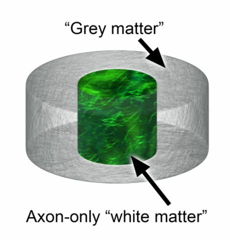 Try not to think about rat-brain donuts.