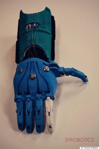 prosthetic-hand-frozen