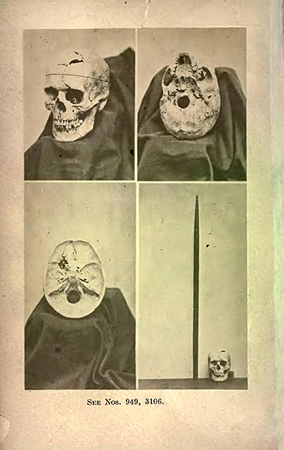 Frontispiece, showing multiple views of Gage's exhumed skull, an