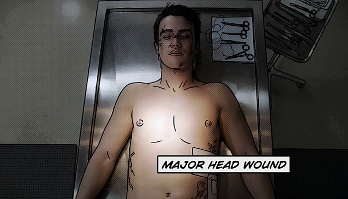 iZombie - Major Head Wound