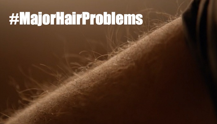 iZombie - Major Hair