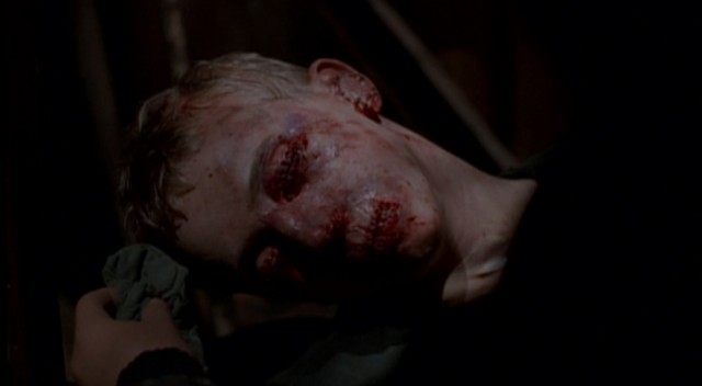 The boy with the sewn-up eyes