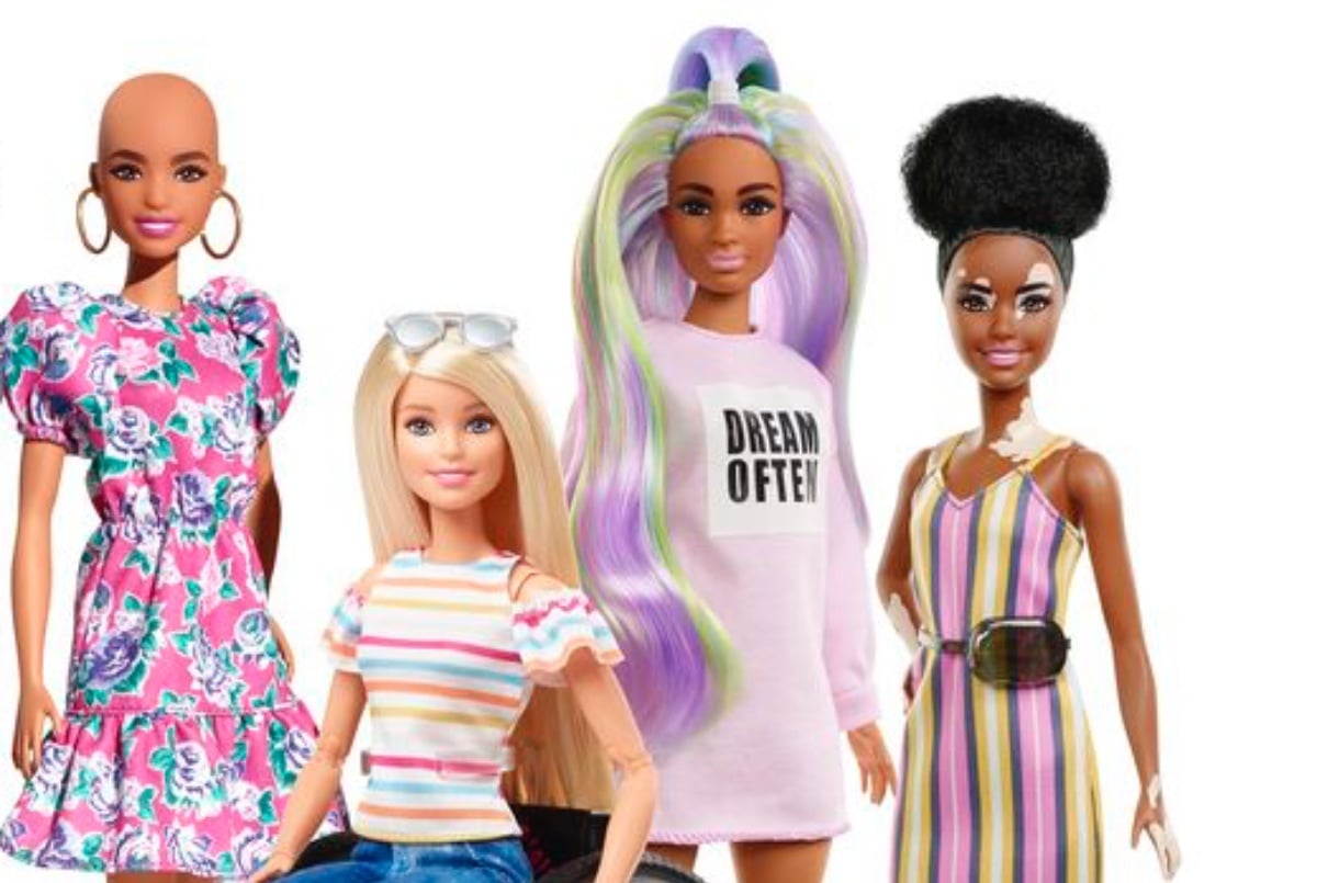 diverse barbies new doll with vitiligo and one with no hair