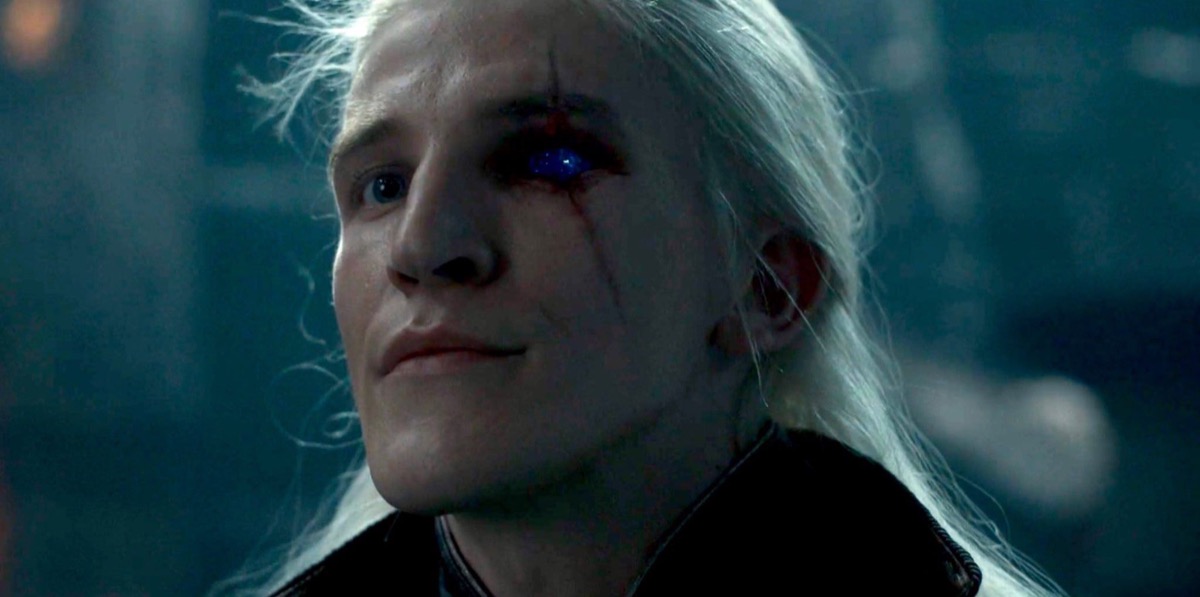 Aemond Targaryen (Ewan Mitchell) reveals the shocking sapphire where his eye once was in 'House of the Dragon'