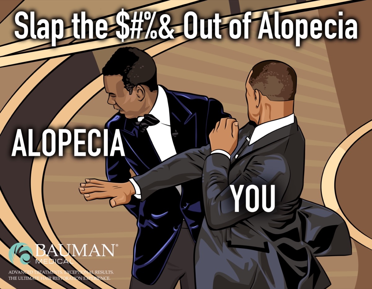 Bauman Medical's promotional graphic depicting the moment Will Smith slapped Chris Rock at the 2022 Oscars, with text that reads "Slap the $#%& Out of Alopecia." Chris Rock is labeled with "Alopecia" and Will Smith is labeled as "you"