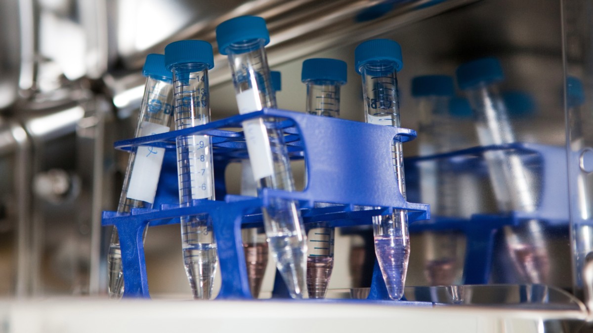 Lab equipment used for In Vitro Fertilization