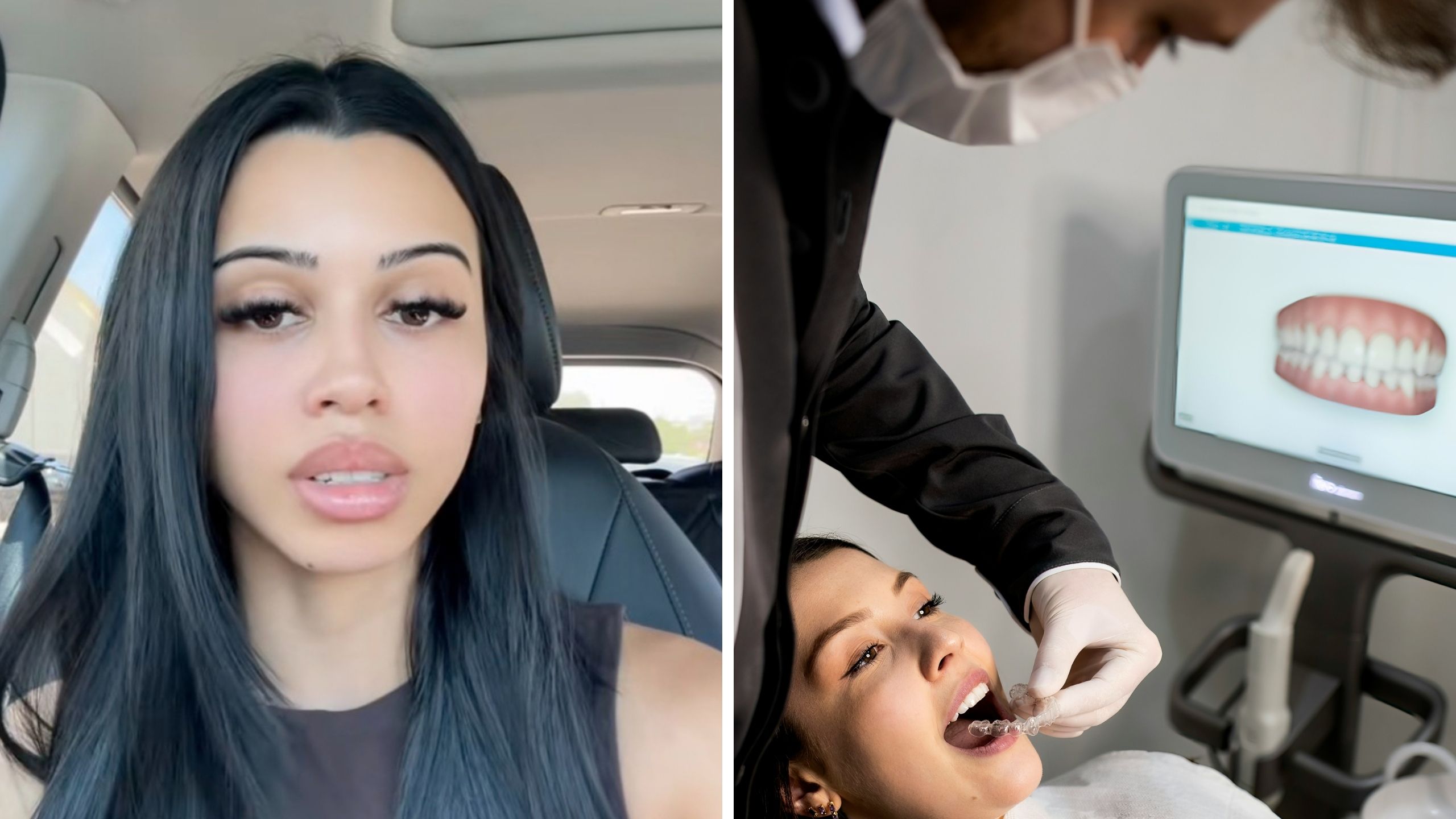 woman sharing her veneers experience (l) dentist checking patient (r)