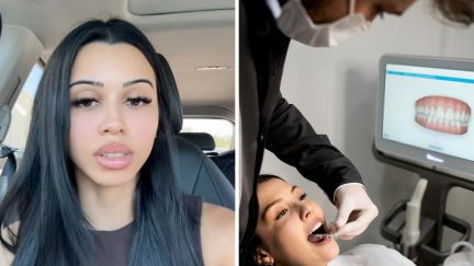 woman sharing her veneers experience (l) dentist checking patient (r)