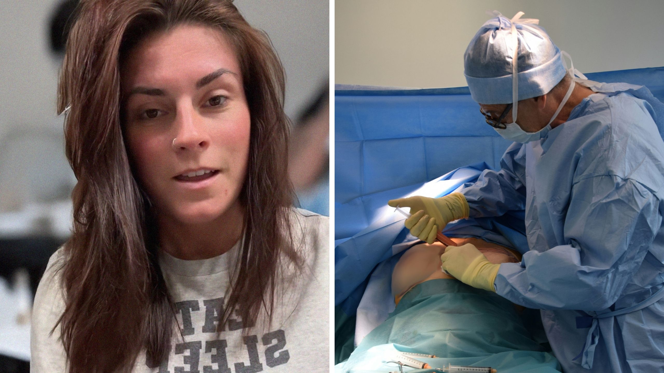 woman shares boob job experience (l) boob surgery (r)