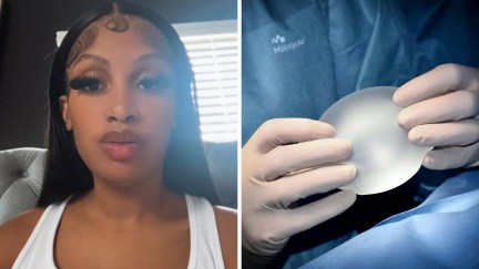 woman shares breast implants experience (l) Doctor holding breast implants (r)