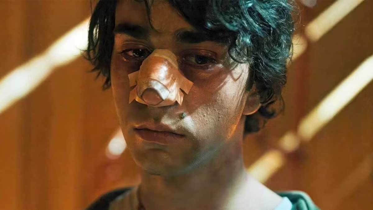 A boy with a broken nose stands calmly in "Hereditary"