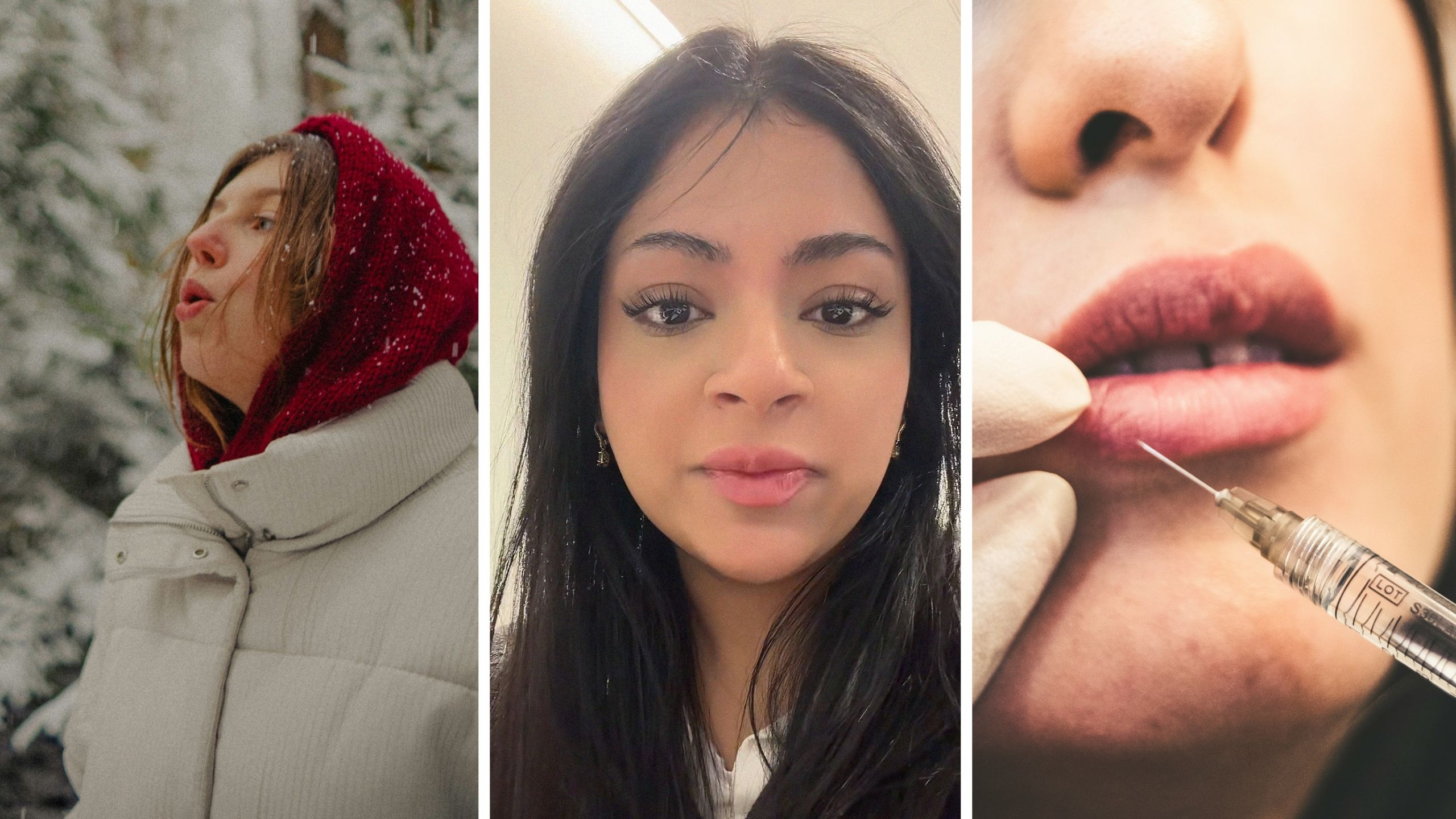 Woman gets lip filler. Then she goes outside in the cold, feels what happens to it: ‘I was not warned’ Woman gets lip filler. Then she goes outside in the cold, feels what happens to it: ‘I was not warned’