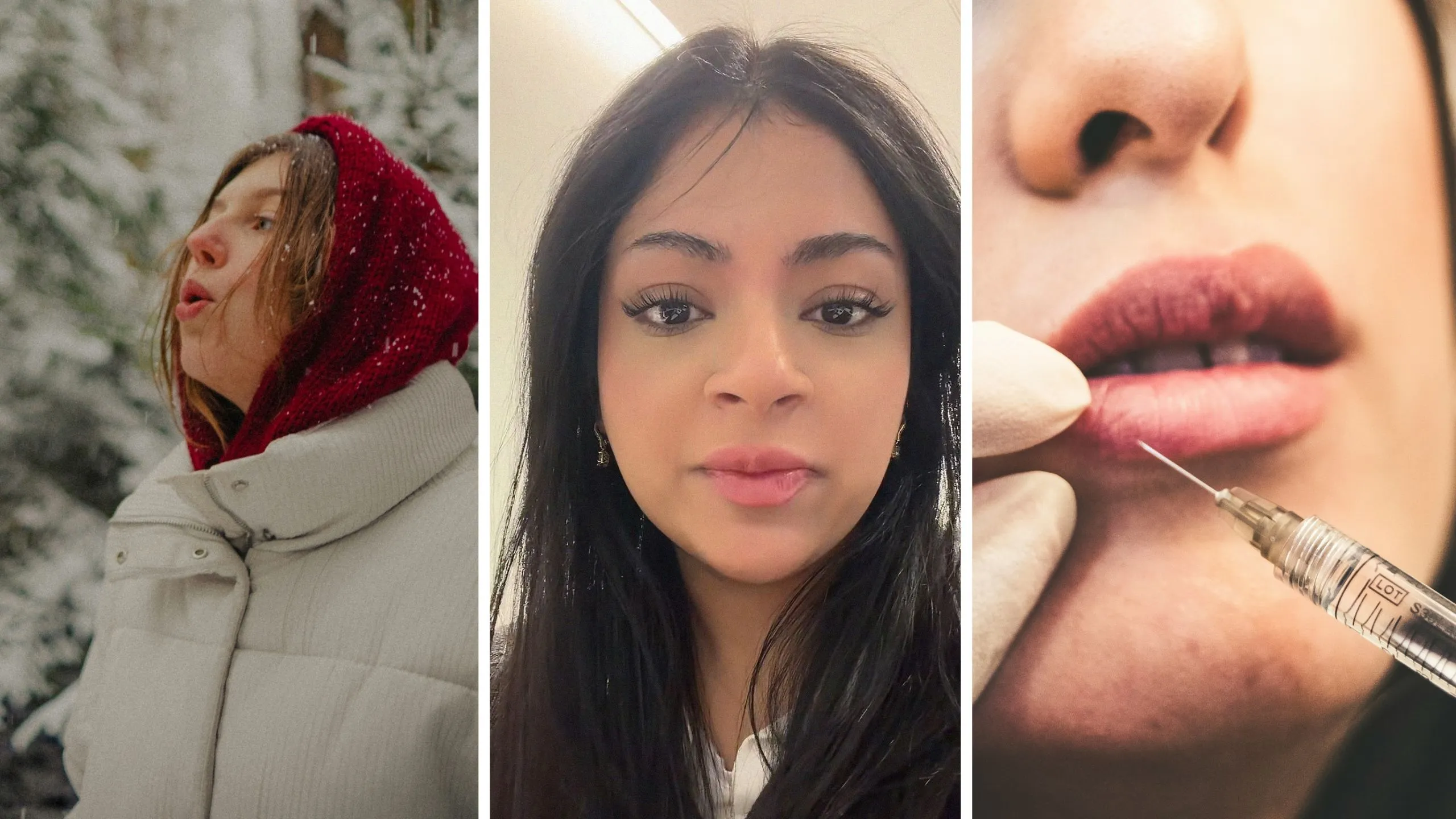 woman goes outside in cold (l) woman shares lip fillers struggles (c) woman gets lip fillers (r)