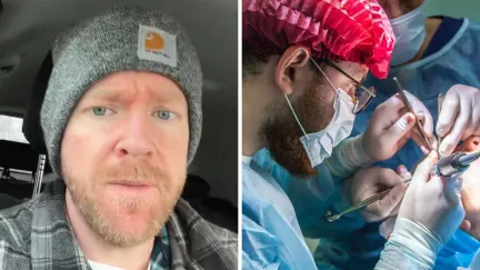 man shares Lasik eye surgery effects (l) Lasik eye surgery (r)