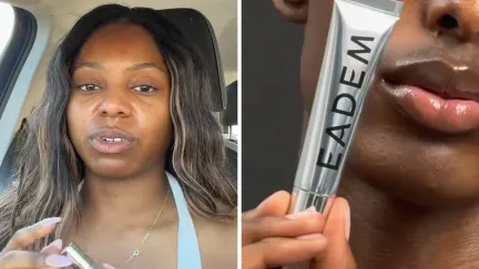 woman shares lip balm issue (l) EADEM lip balm (r)