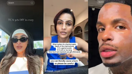 TikTok Users use and discuss chemical peels