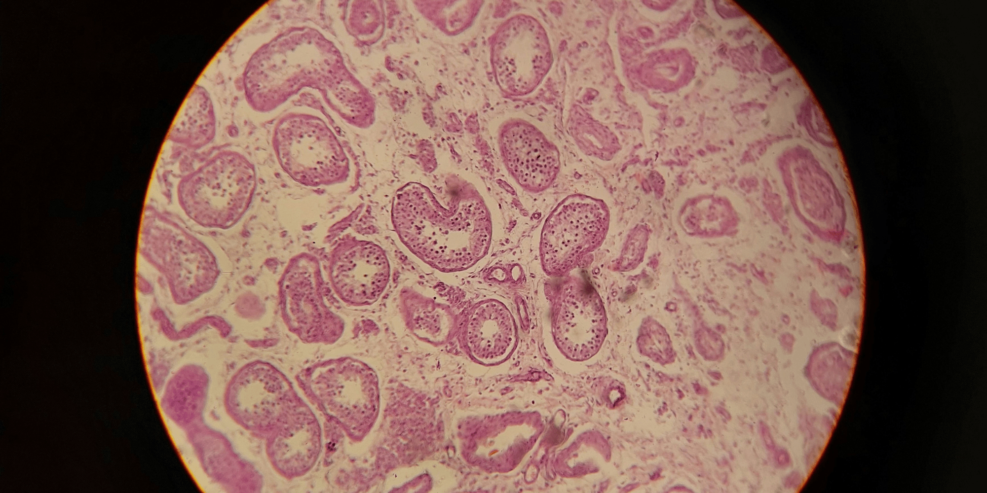 microscopic view of blood cells