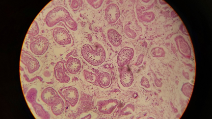 microscopic view of blood cells