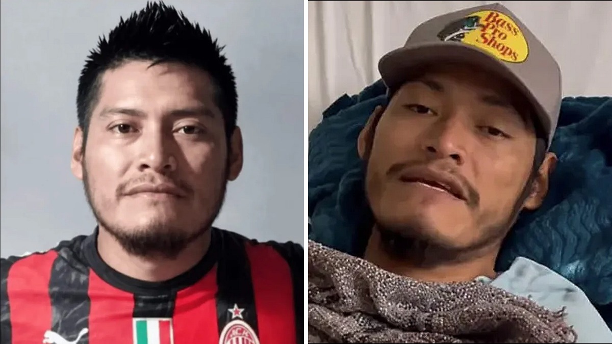 Erasto Crisanto Valdez before & after rescue
