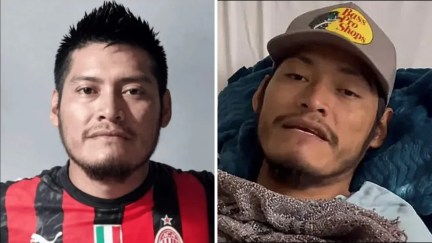 Erasto Crisanto Valdez before & after rescue