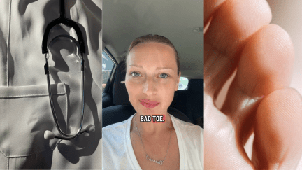 Georgia Woman Noticed She Had a 'Bad' Toe. Then The Doctor Gave an Alarming Diagnosis 'It's Not a Wart'
