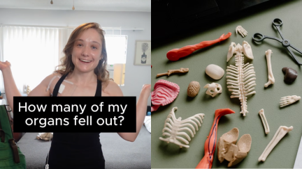 Her pelvic floor collapsed. Now her organs are ‘serial escapees’ that keep falling out of her body