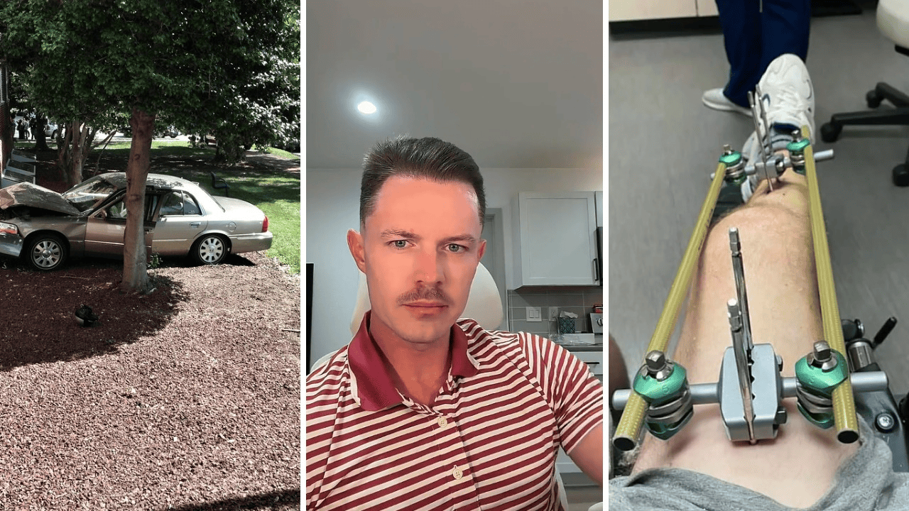 Arizona man slammed into a tree during a seizure. Then, he was unexpectedly charged with a DUI: ‘I had zero alcohol in my system’