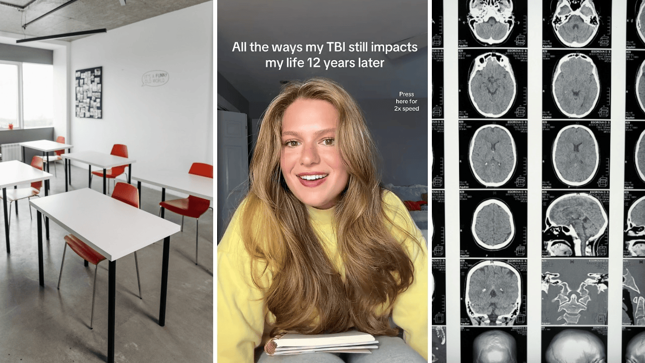 A classmate pranked her by pulling the chair from underneath her. 12 years later, and she’s still dealing with the aftermath