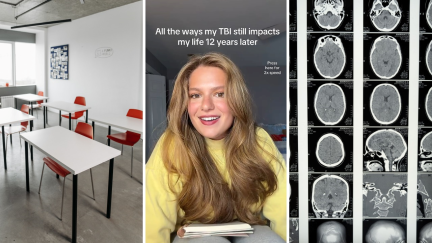 A classmate pranked her by pulling the chair from underneath her. 12 years later, and she’s still dealing with the aftermath